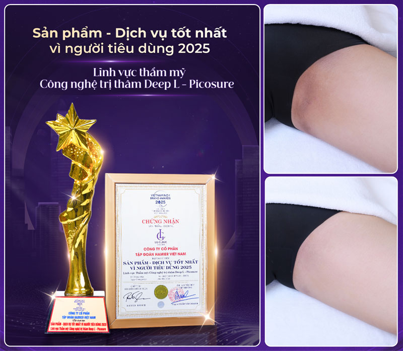 dia chi tri tham mong ben tai viet nam 2